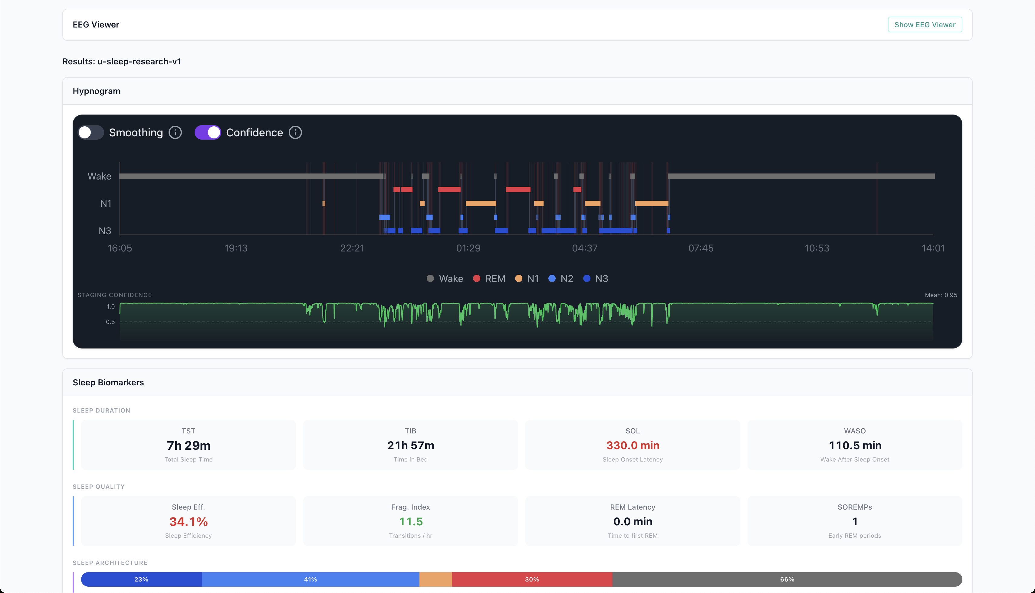 Insai platform showing sleep hypnogram, biomarkers, and recording quality analysis